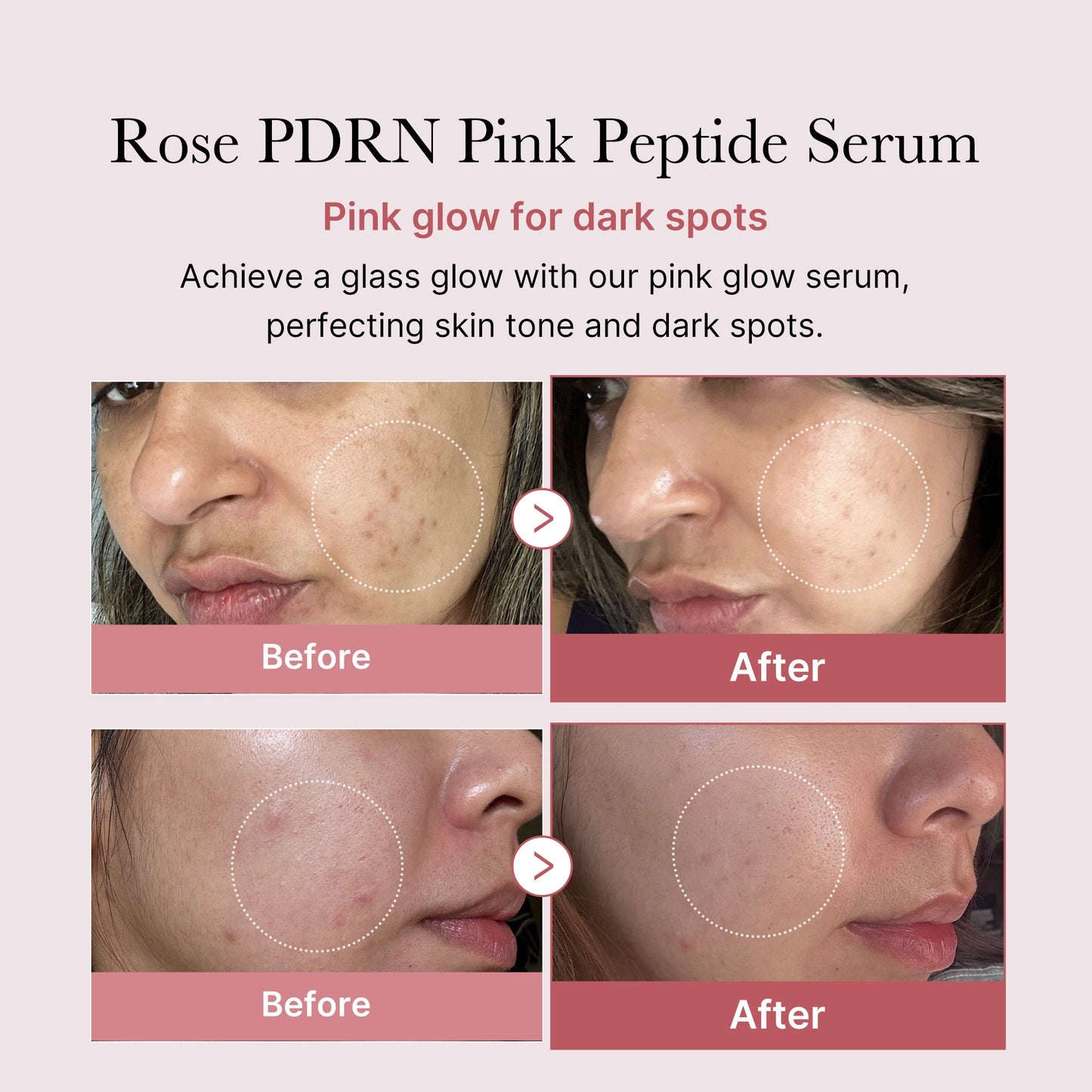 Medicube Pink Peptide Serum